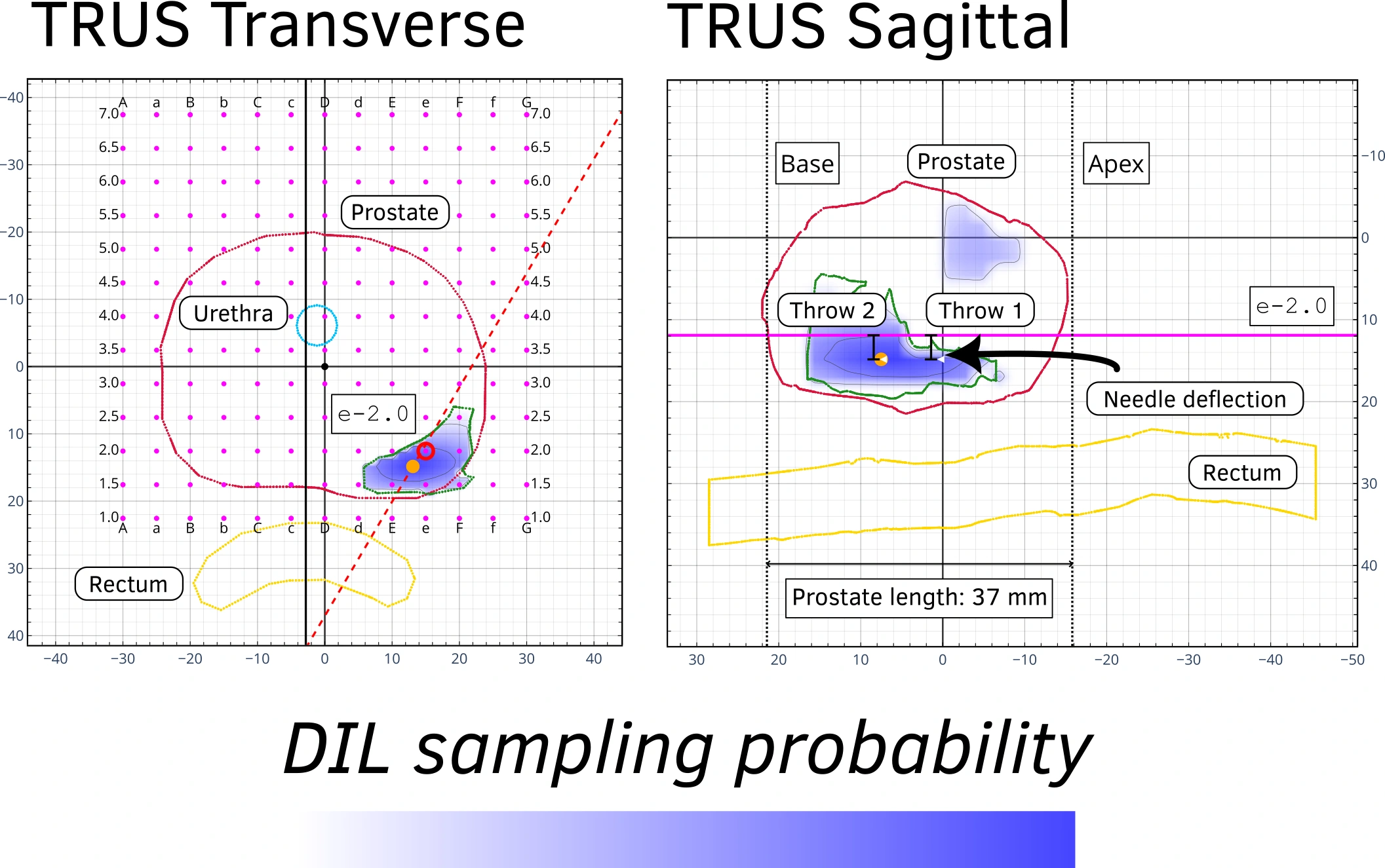 Transverse and sagittal TRUS guidance maps showing anatomical contours, template positions and candidate sampling.