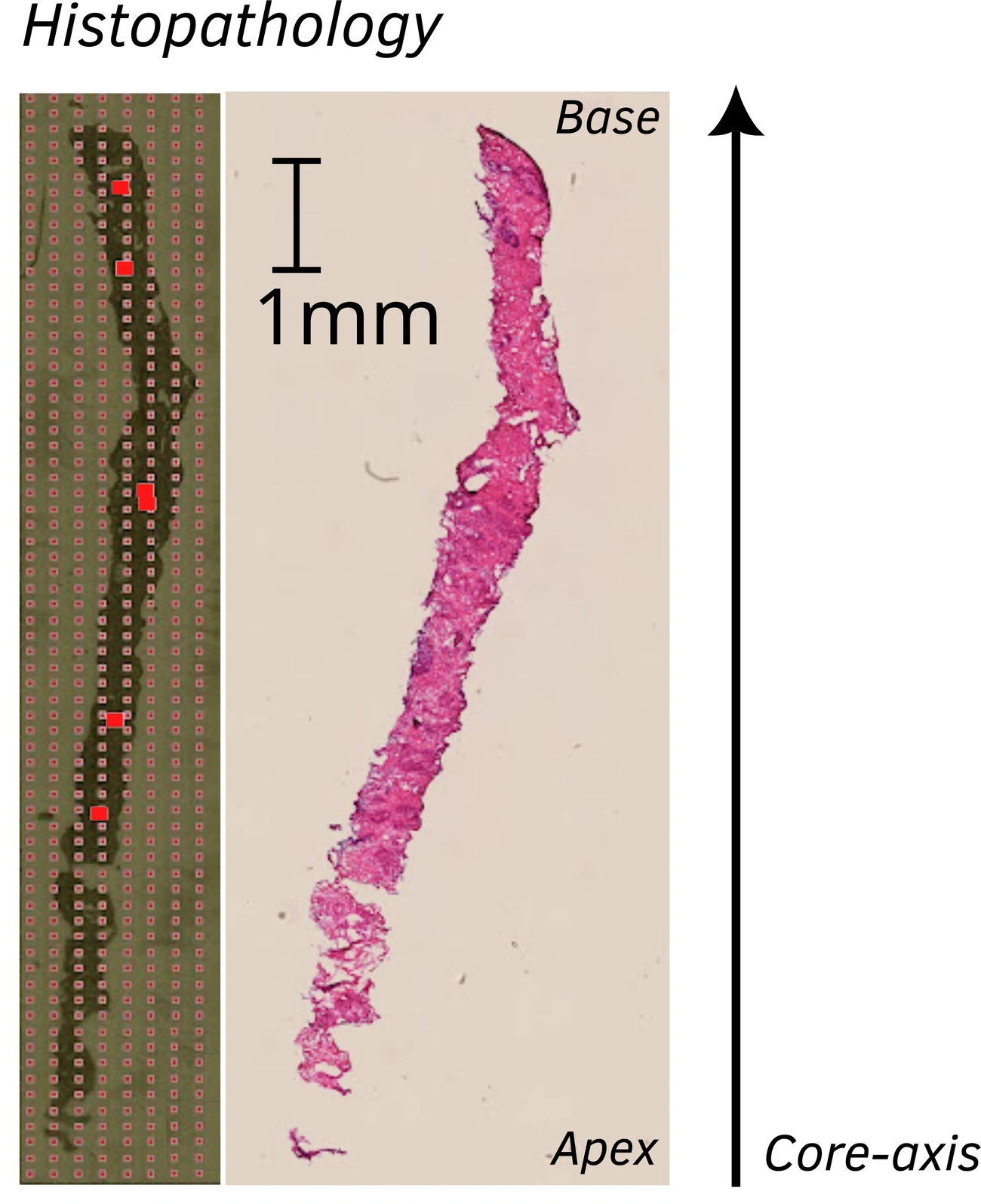 Biopsy specimen, sampling strip, one-millimetre scale and base-to-apex orientation