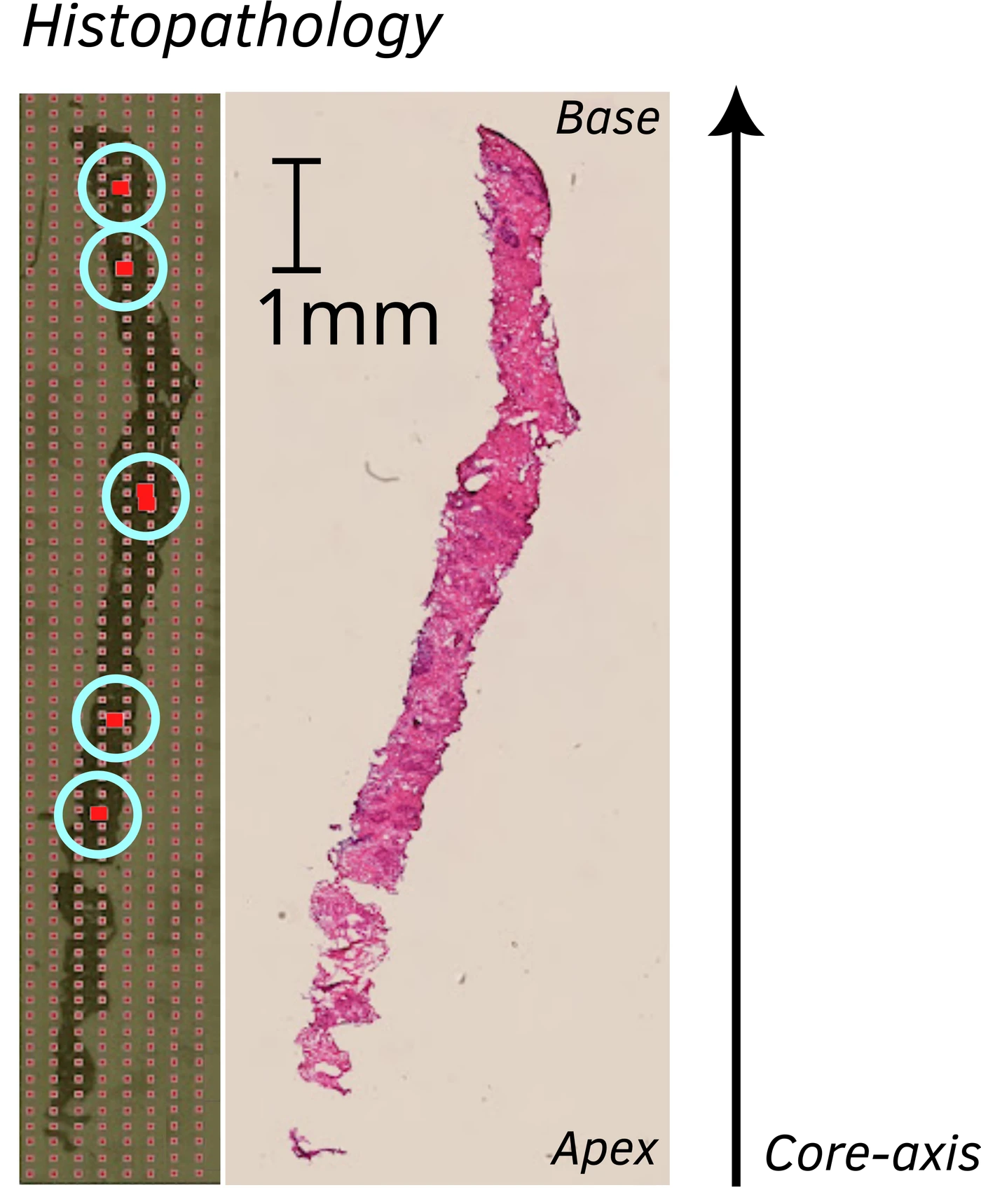 Laboratory sampling sites positioned along an oriented biopsy specimen.