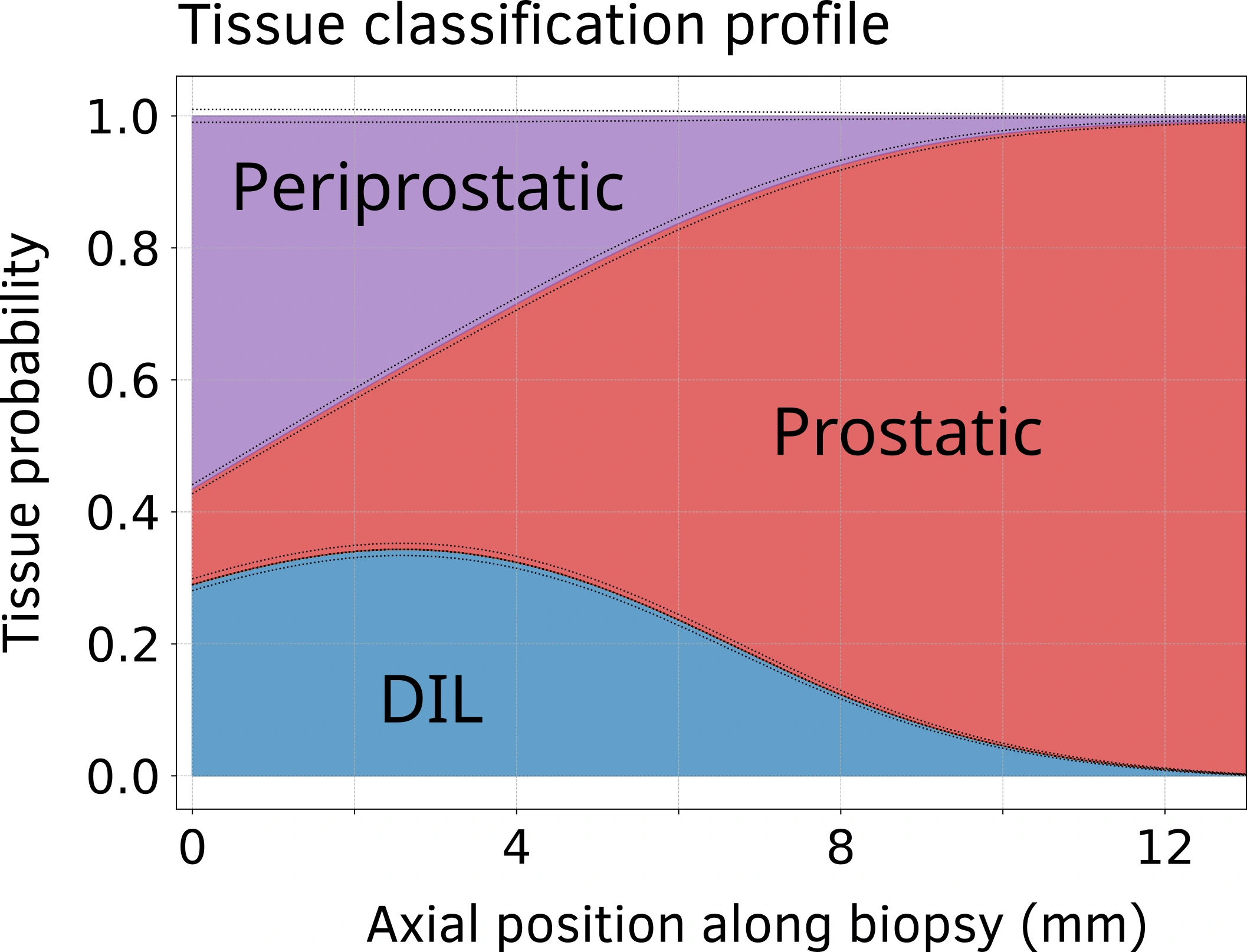 Tissue-class probabilities along a core, with a local lesion-sampling peak and transitions to surrounding tissue.